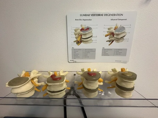 Spinal degeneration models used during your exam